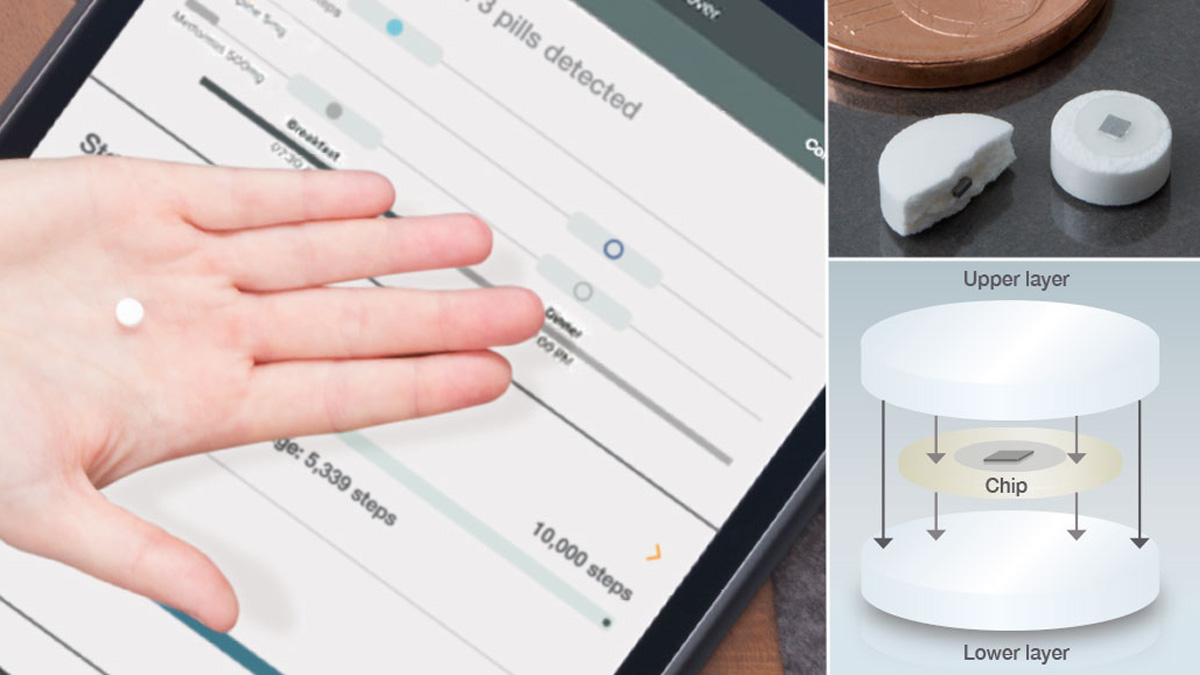 KORSCH Technology Blog